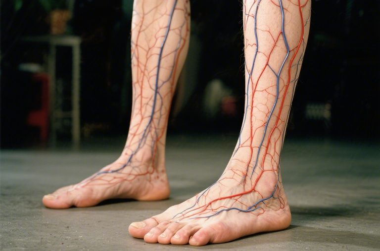 Jakie są przeciwwskazania do presoterapii?